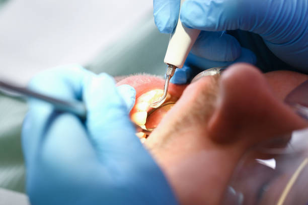 Best 24-Hour Emergency Dental Care in Ames, TX