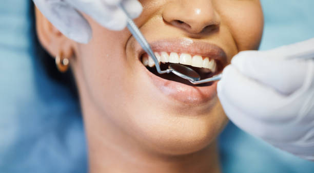 Best Emergency Root Canal Therapy in Ames, TX